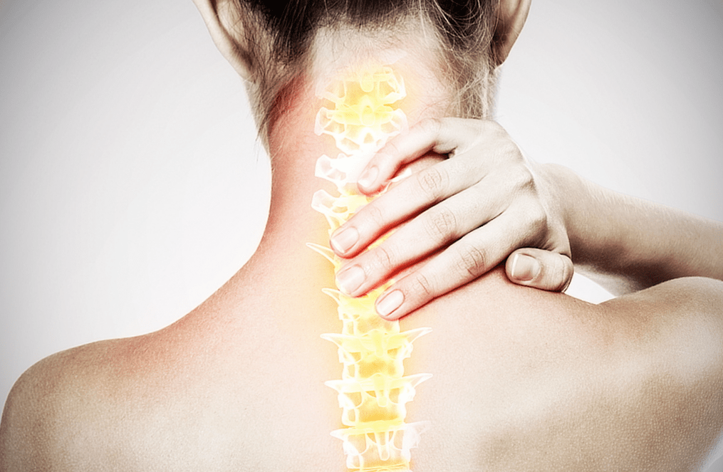 osteocondrose espinhal