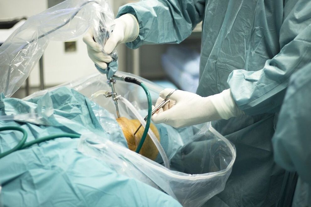 tratamento cirúrgico da artrose