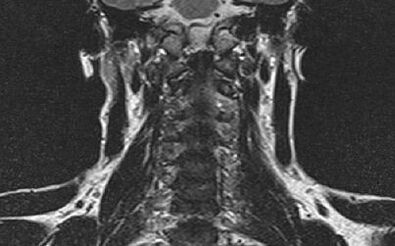 A coluna cervical